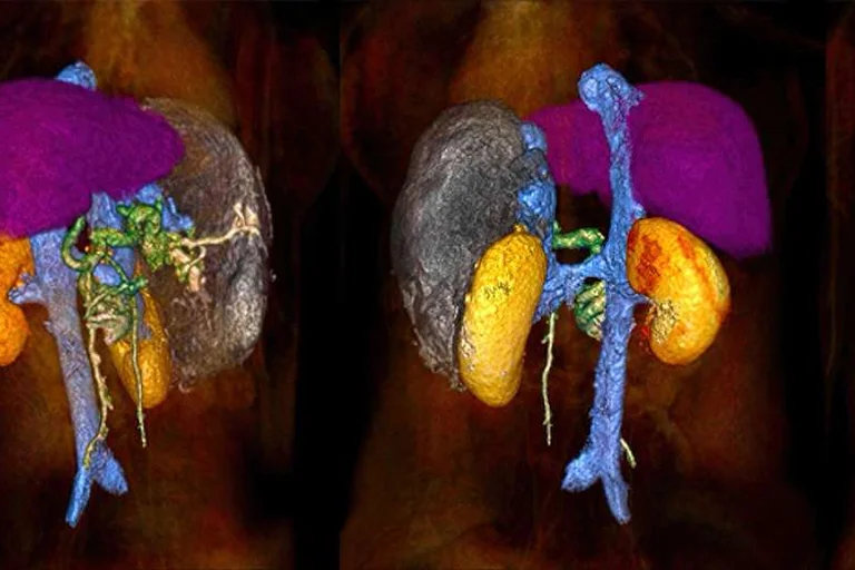 High resolution 3D rendering of human organs